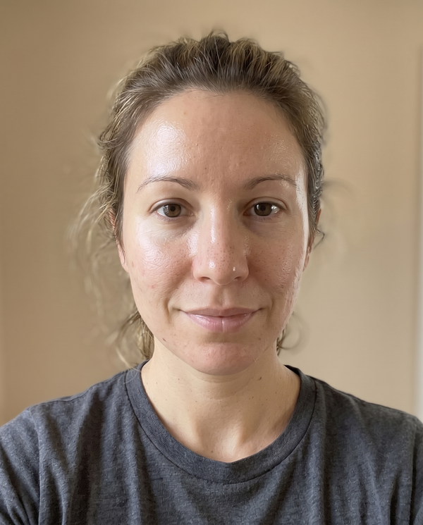 After — Evelyn N, 34