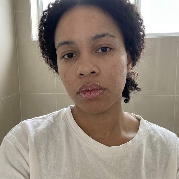 Before — Aïsha, 29