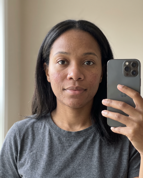 Before — Amelia G, 32