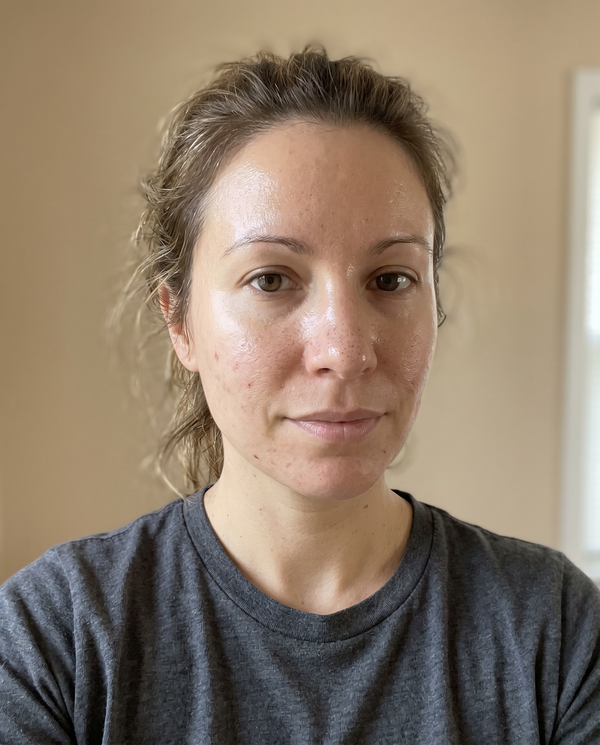 Before — Evelyn N, 34