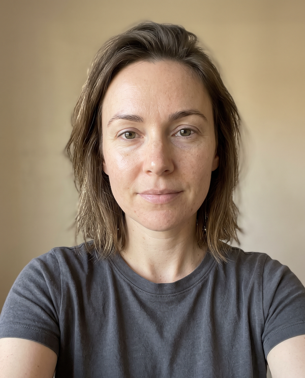 Before — Olivia M, 34